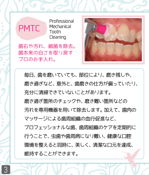 予防歯科-PMTC